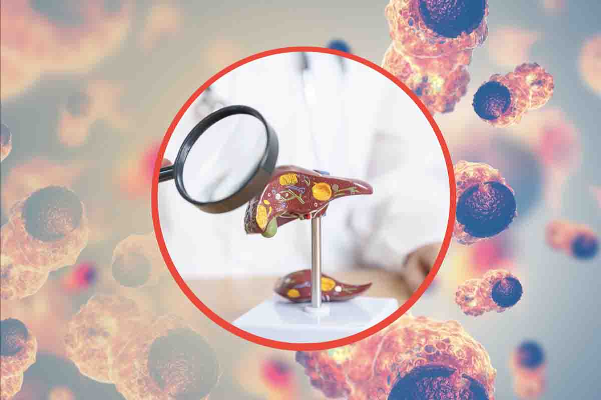 Sintomi patologie del fegato