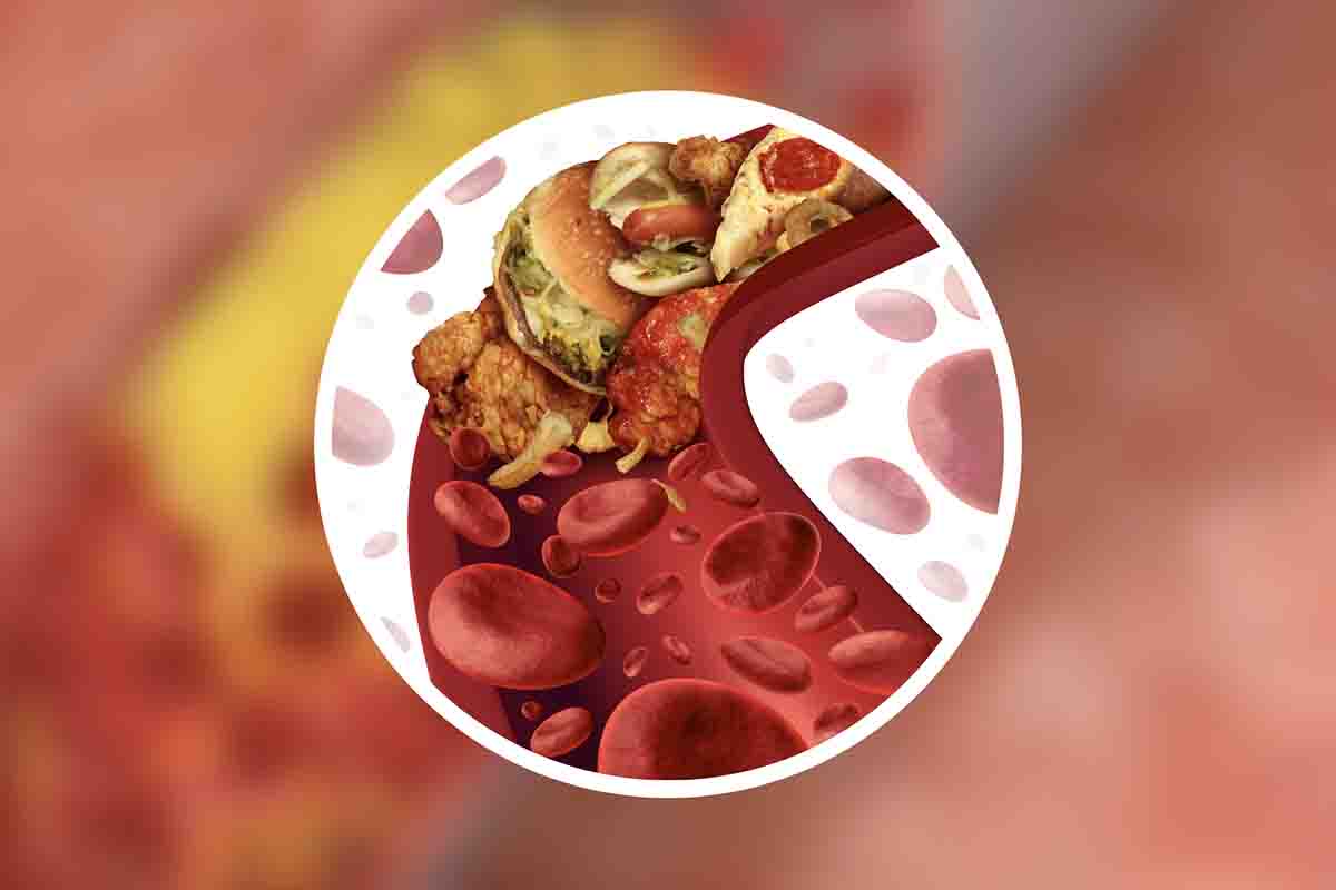 colesterolo alto conseguenze devastanti ecco i sintomi